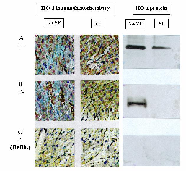iszkémia/reperfúziónak kitett szívek esetében, immunhisztokémia és Western blot segítségével (8. ábra). 8. ábra: A HO-1 expresszió változása iszkémia/reperfúziónak kitett izolált egérszívben.