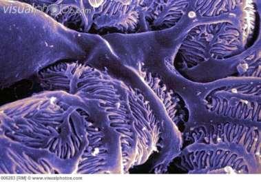 stb Glomerulus 1 2 3