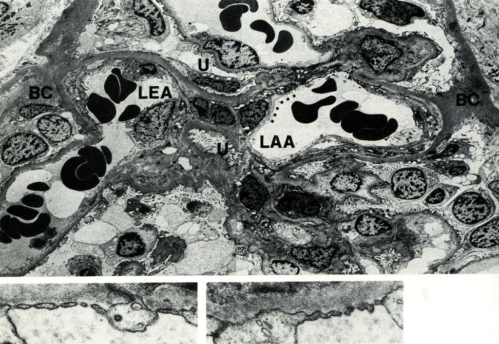 BC LEA U U LAA fenesztráció EM Micrograph: Horizontalis