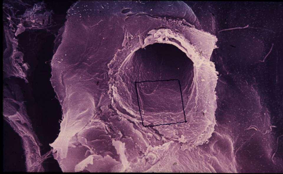 Scanning EM Micrograph: Az afferens arteriola disztális szakasza