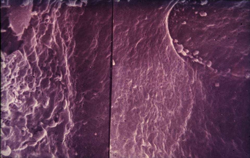 SEM: afferens arteriola disztális végének endotheliuma (Az arteriola