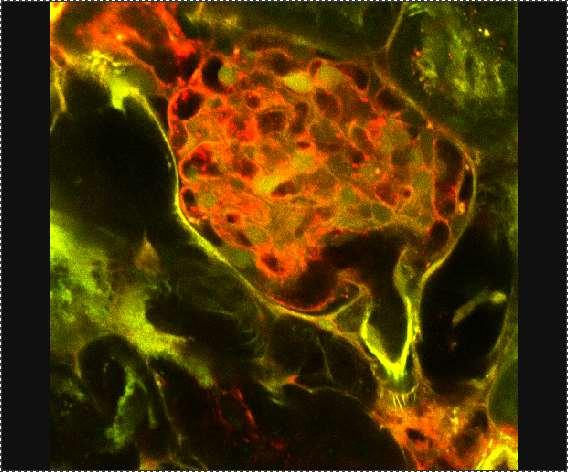 PT G G AA R AA Glomerulus vizualizálása in vivo (egér) multiphoton