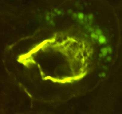 A B G JG JG AA P P Az affarens arteriola (AA) disztális részének multiphoton