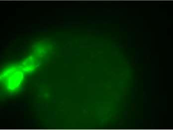 MD cilia ingerlés Afferens