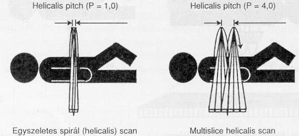 térbeli képalkotás 1 mm szeletvastagság Többsíkú