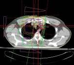eszközök, maszkok Képillesztés CT különbözı