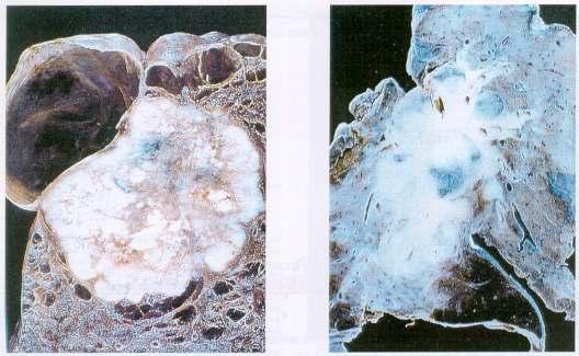 Tüdırák etiológiája 1. Elsı helyen a dohányfüst áll! 90%-ban oki tényezı 40 kémiai anyagot tartalmaz, melyek többsége carcinogén 2. Kátrány: szabad gyökök miatt 1.Törést okoz a DNS-ben 2.