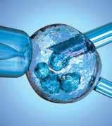 ro Criterii pentru inseminare intrauterină: Ambele trompe uterine sunt permeabile, sau cel puțin una; O concentrație și o motilitate a spermei care permit IUI minimum cinci milioane de spermatozoizi