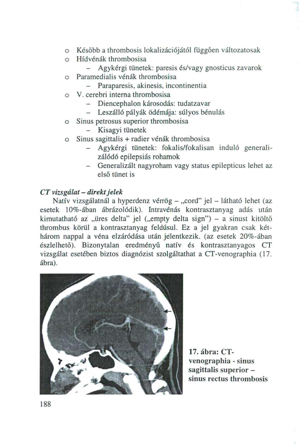 o o o o o o Később a thrombosis lokalizációjától függően változatosak Hídvénák thrombosisa - Agykérgi tünetek: paresis és/vagy gnosticus zavarok Paramedialis vénák thrombosisa - Paraparesis,