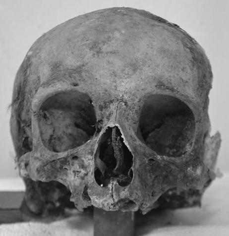 a b 5. ábra: Gróf Dessewffy Emil valószínű koponyája. Fig. 5: Cranium attributable to Count Emil Dessewffy.