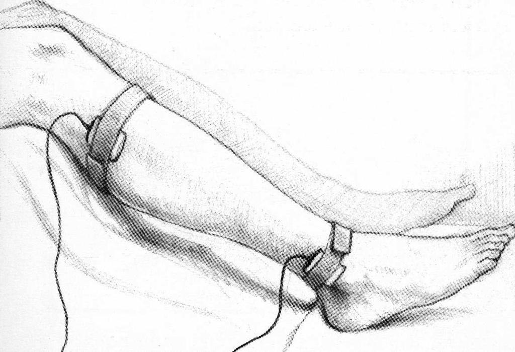 Elektroterápia(Ingeráram terápia) Az ingeráramkezelések közül a neuromuscularis elektrostimulációt (NMES), és a functionalis elektrostimulációt (FES) használjuk a leggyakrabban, de probléma, hogy a