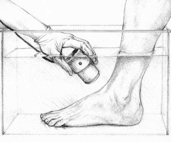 Ultrahang terápia Rövid távú jó hatást észleltek a vizsgált paraméterekben a pulzáló ultrahangban részesülteknél, a stancioner ultrahang kezelésben részesültek és a placebo ultrahang kezelésben