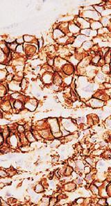 oestrogen,