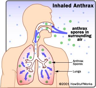 2. Tüdőanthrax : haemorrhagiás pneumónia Rapid