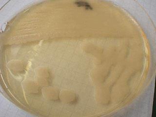 Bacillus cereus Tenyésztés :