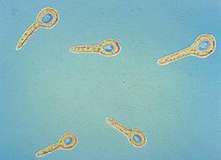 Clostridium tetani Morfológia: