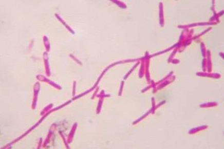 Clostridium botulinum morfológia 3-5 m vastag, Gram-pozitív csillós pálca