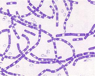 Bacillus anthracis Morfológia: - Vaskos Gram-pozitív, csillótlan pálca (8 m), jellegzetesen levágott végekkel - Idős