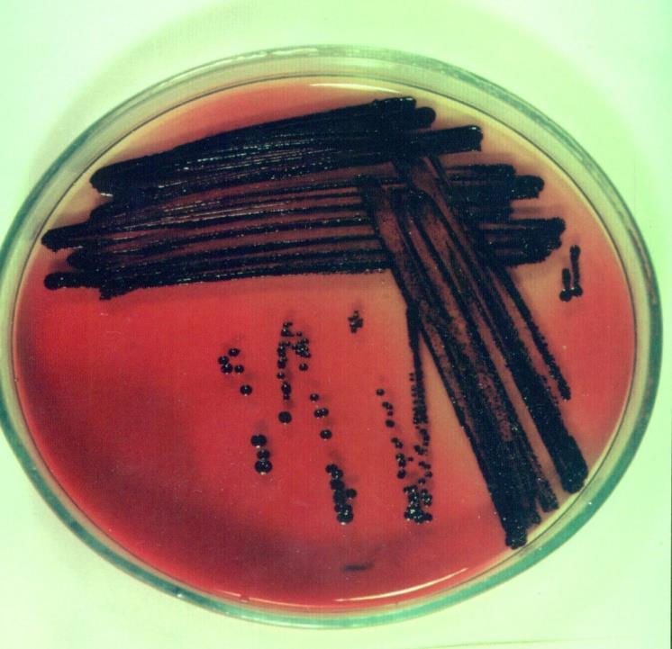 - collagenase, -