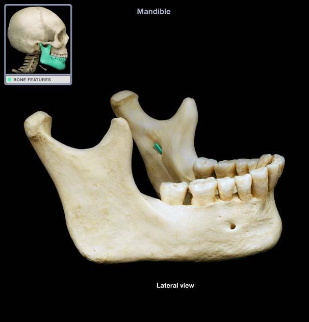 Mandibula 3 4 basis (1) ramus (2) processus condylaris (3) processus coronoideus (4) incisura mandibulae (5) angulus