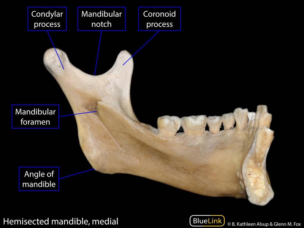 Mandibula 1 lingula (1) foramen mandibulae sulcus mylohyoideus linea mylohyoidea tuberositas pterygoidea (2) fossa