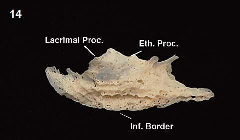 maxillaris processus