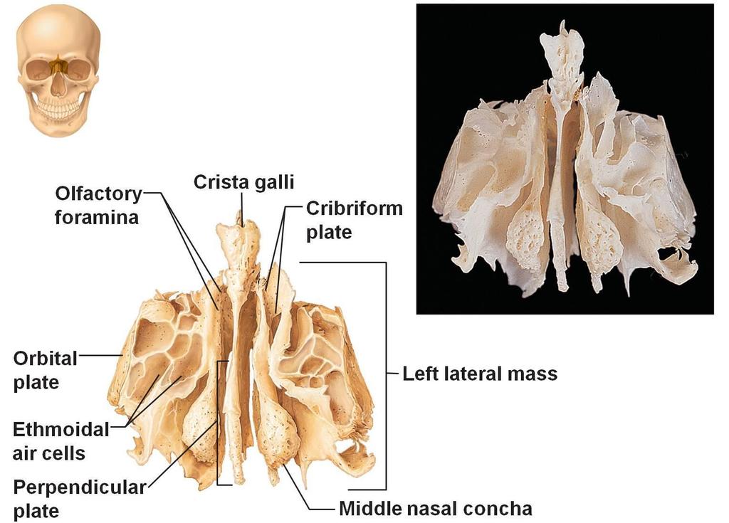 Os ethmoidale: lamina cribrosa cellulae ethmoidalis