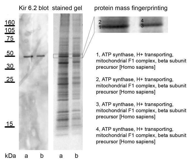 Brief description of the results Aim1: investigation of mitokatp channels The mitochondrial ATP-sensitive K + (mitokatp) channel was first described nearly fifteen years ago and it has been a major
