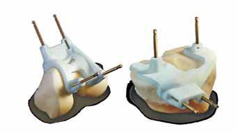 knees ArE