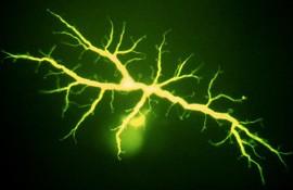 Retina neuron típusai: 1.