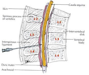 SPINALIS ANESTHESIA RÉTEGEK BŐR Llig.