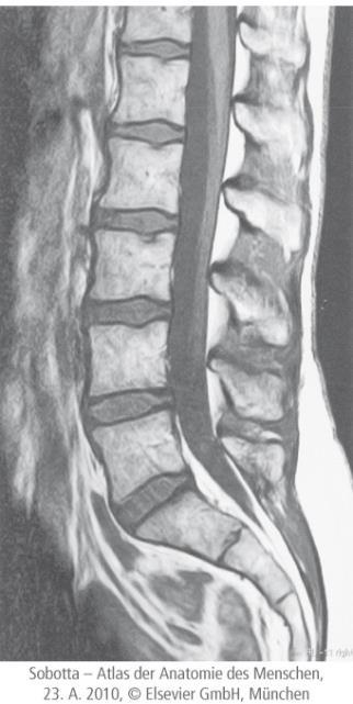 flavum Endorachis Spatium epidurale Dura