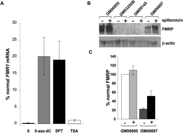 6.3 Splitomicin képes növelni az FMRP szintet az FXS sejtben A GM06897 sejtvonal 300 µm splitomicinnel való kezelése után kétszeresére növekedett FMR1 mrns-t detektáltunk, ami az FMRP mennyiségét is