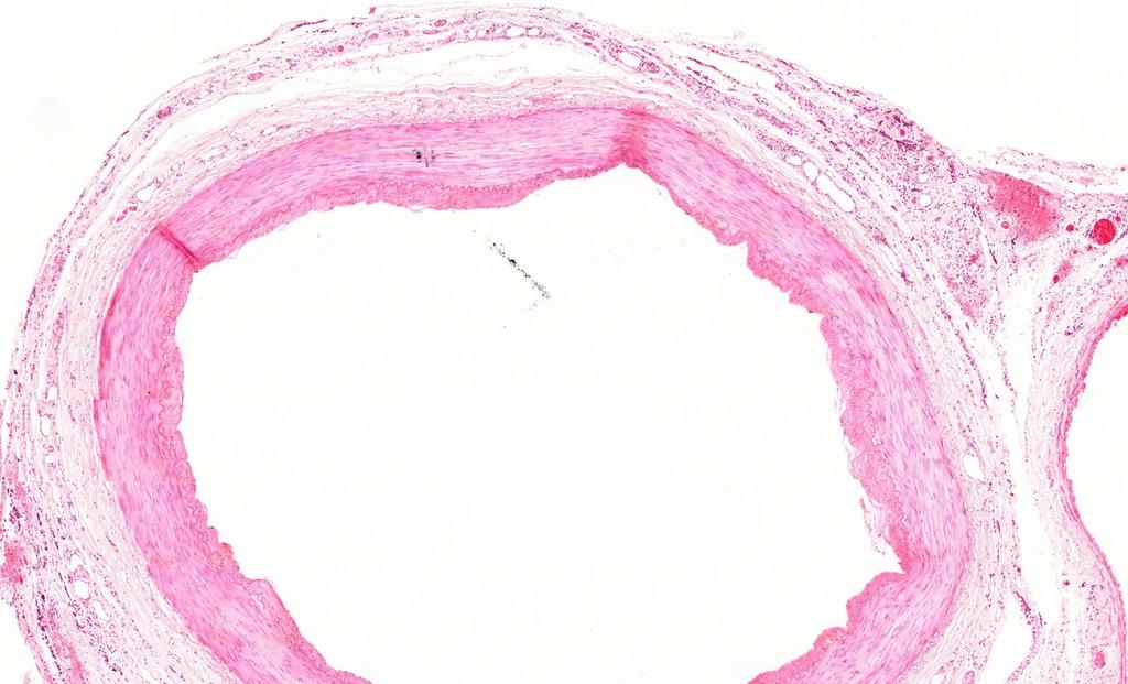 ARTÉRIA (HE) 5X - Izmos típusú artériák a metszet gyűrődése, artefaktum t. intima:endothel réteg, lamina basalis, str. subendotheliale membrana elastica interna : t.