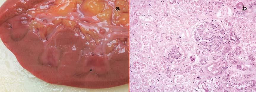 23. ábra: A vesében látható elváltozások (Festés: hematoxillin-eosin [b, c, d, e, g, h], Sudan Black B
