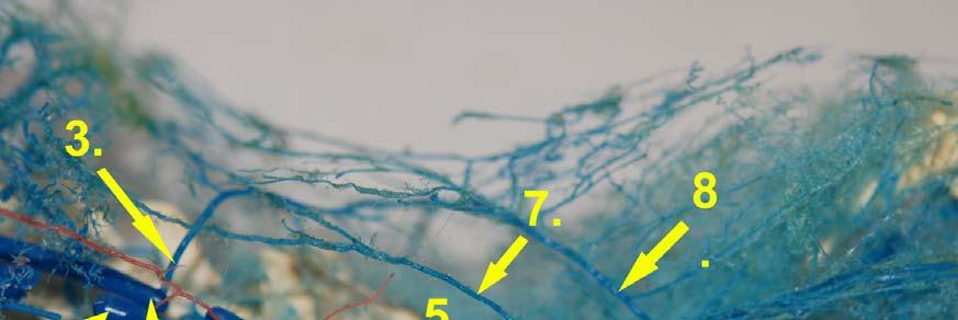 32. ábra: Az alsó testfélből eredő kollaterális hálózat. 1. aorta abdominalis 2. vena cava inferior 3. a. iliolumbaris sinistra 4. a. iliolumbaris dextra 5. a. iliaca communis 6. a. iliaca externa 7.