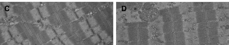 ábra: A mitokondriumban szegény (A, C), illetve a mitokondriumban gazdag (B, D) izomrostok elektronmikroszkópos képe iszkémiás-reperfúziós károsodást követően A, B: 8