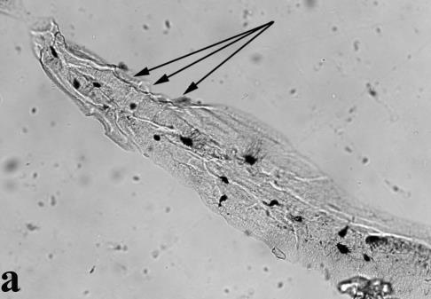 3. ábra: Nigrovits József (29. számú múmia), csigolyatest. Vékony-réteg csiszolat (70 µm); a b: transzmissziós, c: polarizációs mikroszkópos felvétel. 200x nagyítás.