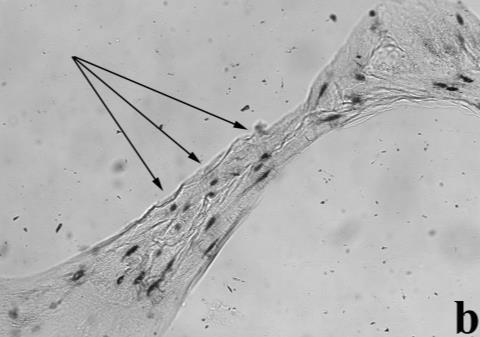 3: Vertebral body of József Nigrovits (No 29). Thin-ground sections (thickness 70 µm); a b: viewed in plain, c: viewed in polarized light. Magnification 200x.