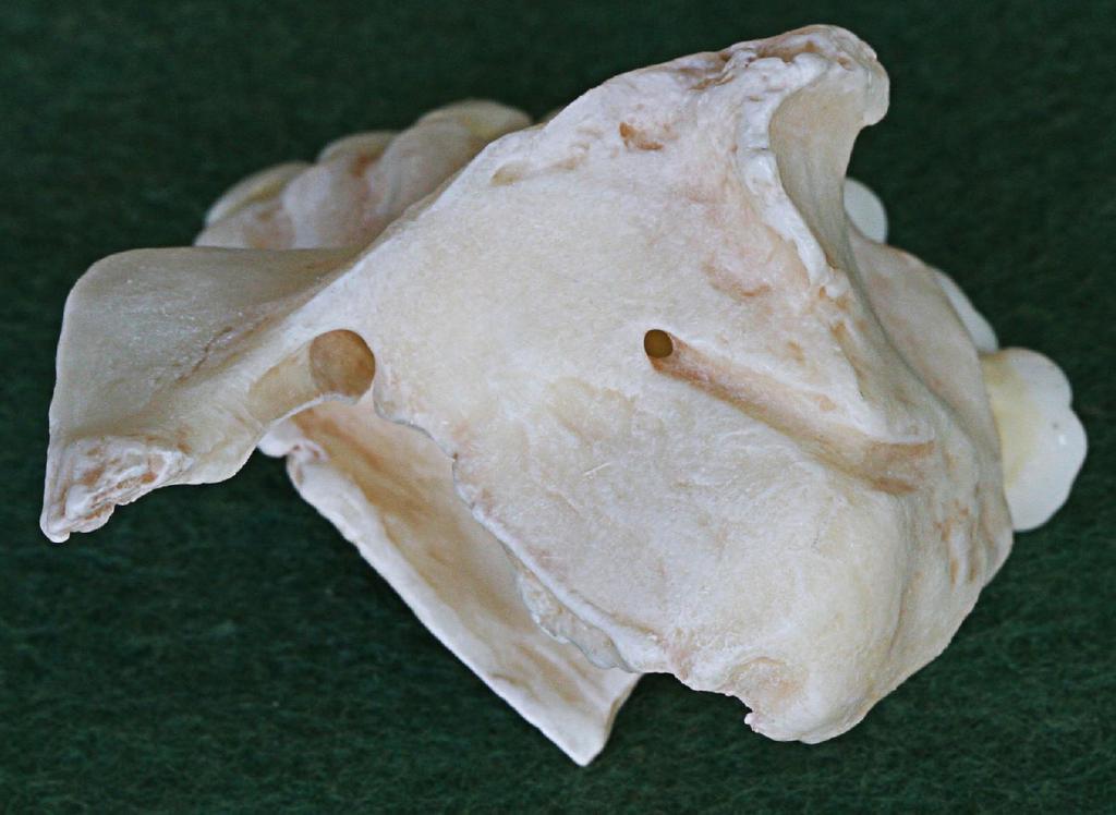 B maxilla A. Proc. Frontalis 1.Incisura lacrimalis B.Proc. Zygomaticus C.Proc. Palatinus 2.