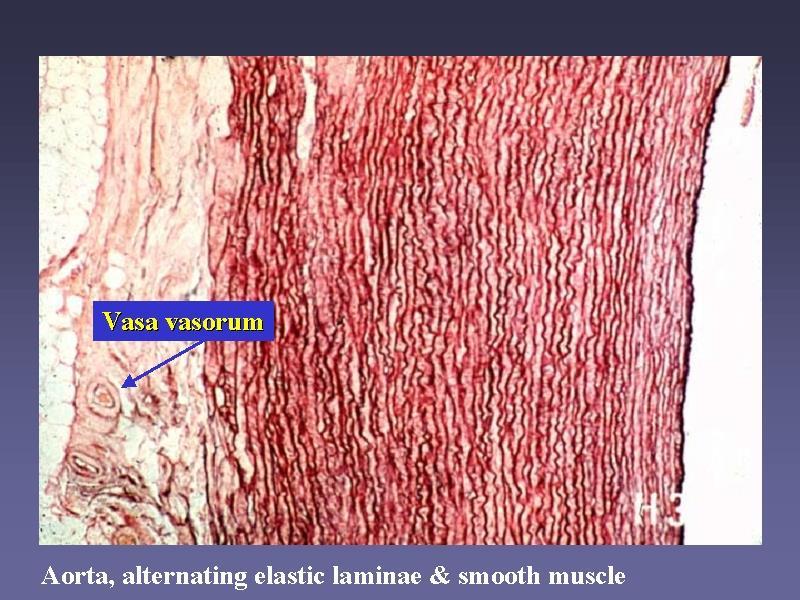 Aorta azok a finom vérerek, melyek a nagyobb vérerek