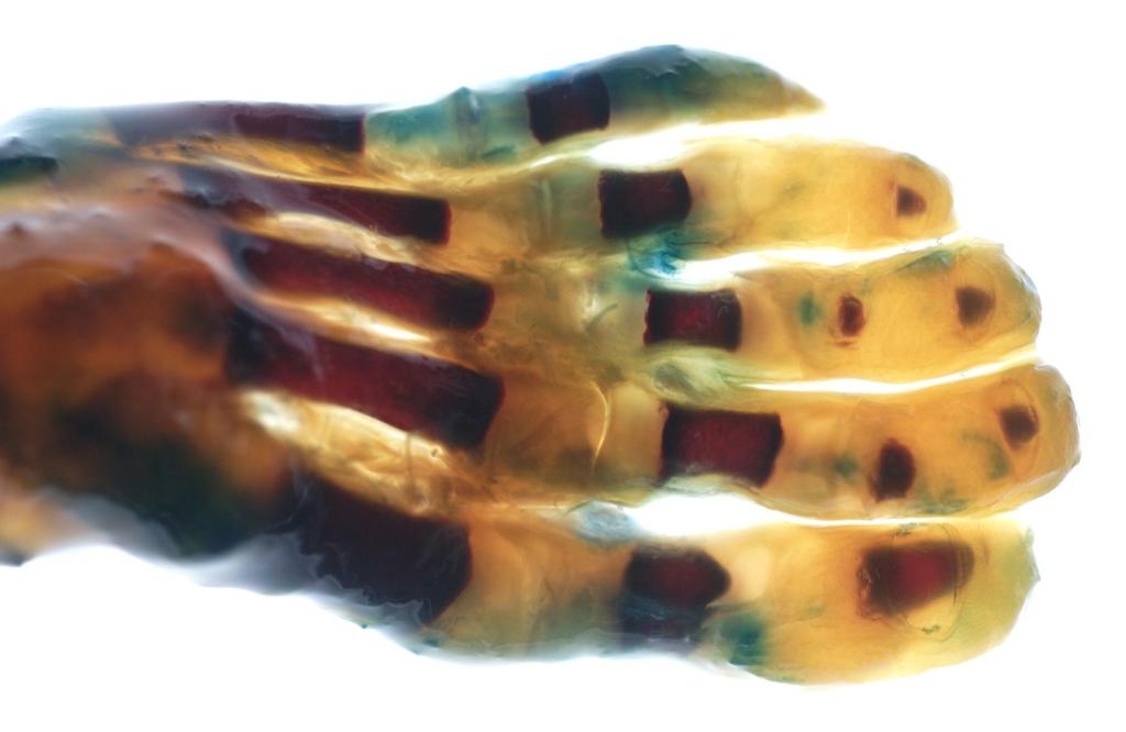 Fetaler Fuβ, 20 Wochen alt, Alisarinrot Färbung Glycerin Aufhellung