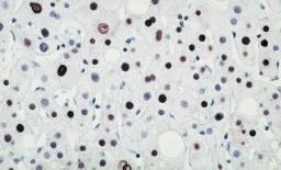 epitóp-fajlagos jel érzékenyebb detektáló rendszerek bevezetését igényelte (avidin/ streptavidin-biotin, jelölt polimer), melyek