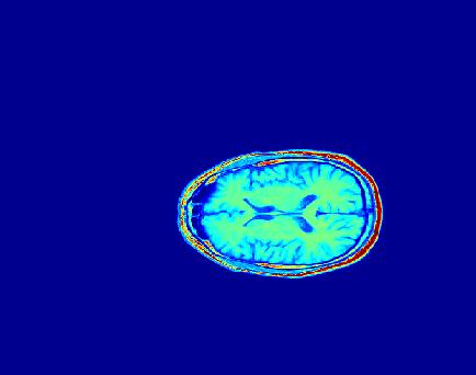 Példa Fourier regisztráció 00 00 00 00 300 300 400 400 500 500