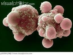 10:55 11:05 Szünet 11:05 11:15 Szabó Ildikó, ELTE-MTA Peptidkémiai Kutatócsoport (szaboi8@gmail.com, http://peptid.chem.elte.hu/indexhu.