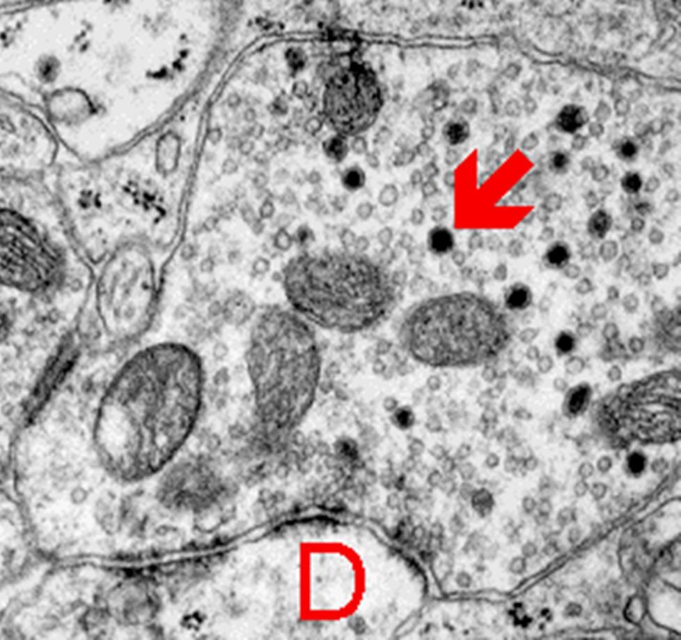 NEUROPEPTIDET TARTALMAZÓ