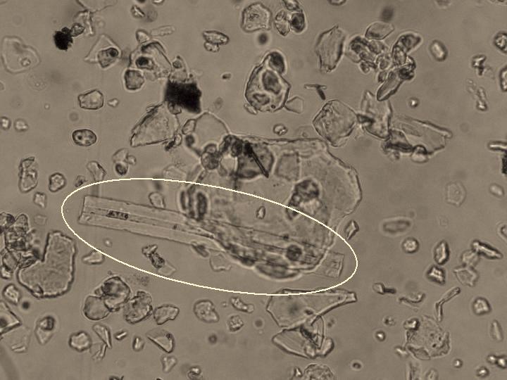 PETÕ ) 5. ábra Szivacstüske a III./1. - Ap mintában (fénymikroszkópos felvétel: PETÕ Á. ) Figure 5. Spicule of sponge from sample III./1. - Ap (lightmicrophotography: Á.