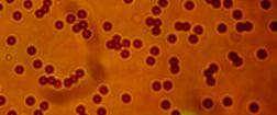 Az izolált sejtek számát fluorescens mikroszkóp