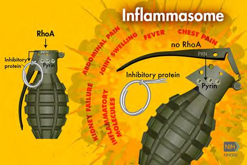 Pyrin inflammasoma activation and RhoA signaling in the