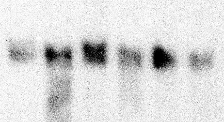 Ennek megfelelően e csatornák expressziós szintje igen alacsony lehet, csak a rendkívül érzékeny RT-PCR eljárással sikerült glomerulóza RNS-ből terméket sokszorosítanunk TWIK-1 illetve TREK-1